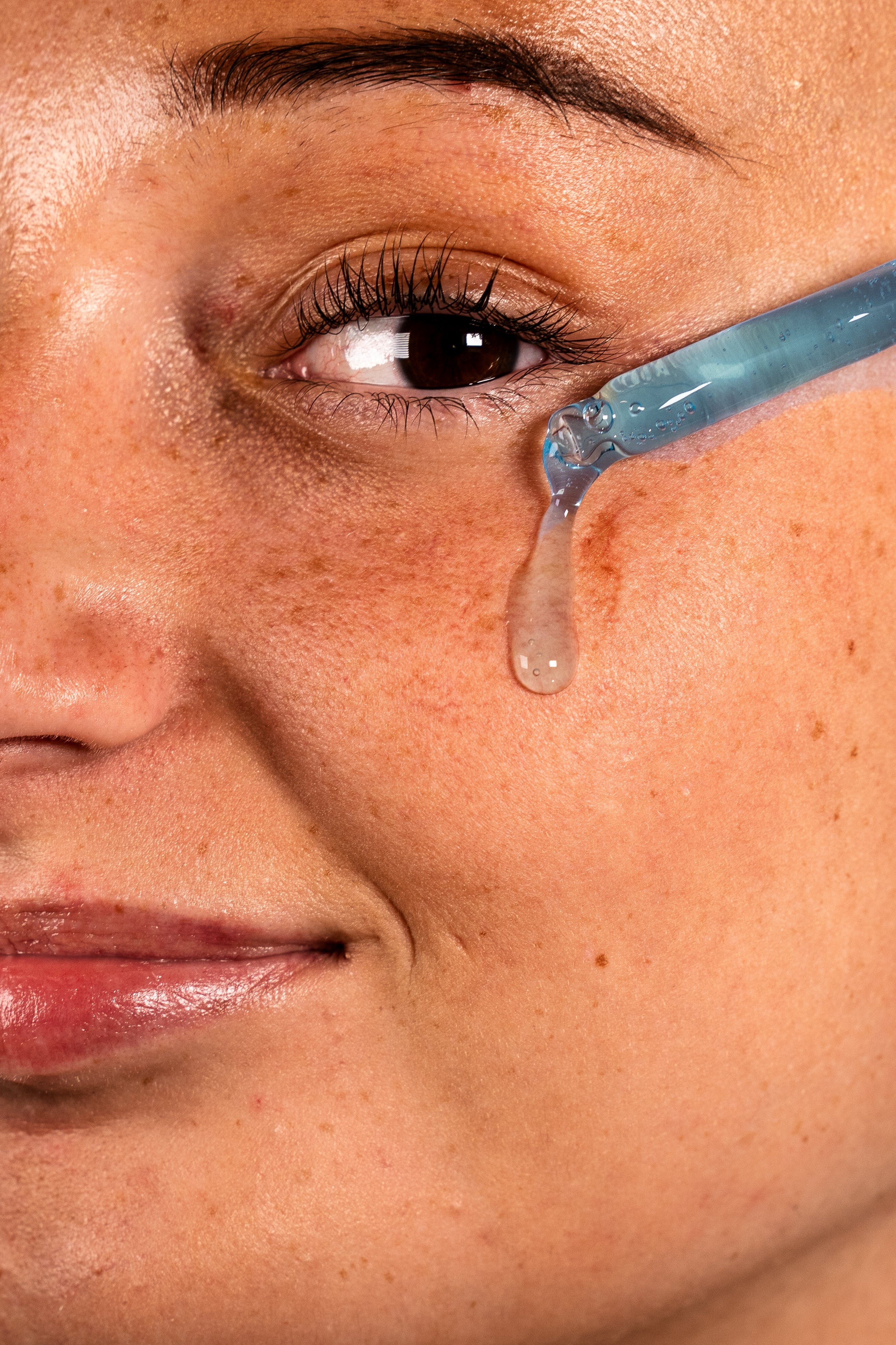 Prévenir & Traiter les Taches Brunes et l'Hyperpigmentation avec le Nila