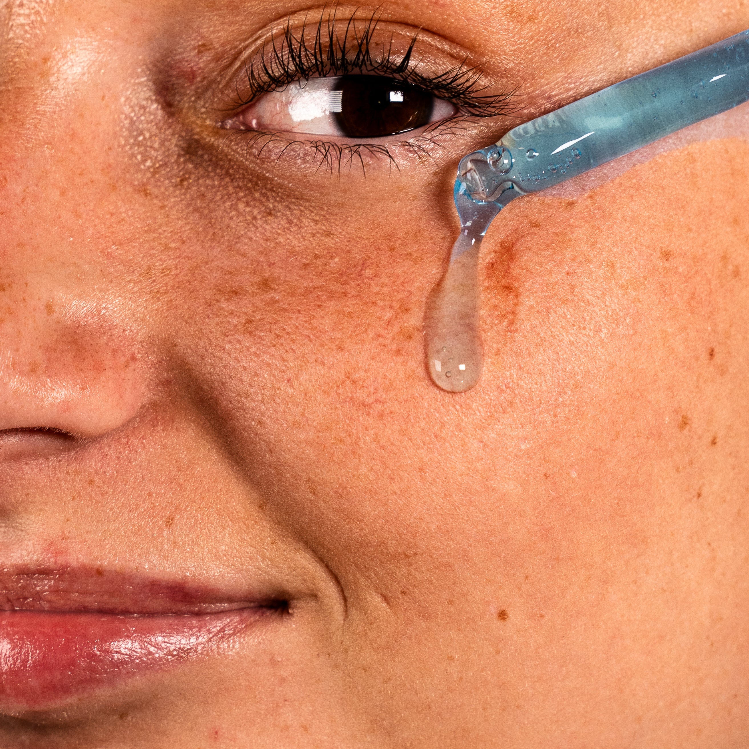 Prévenir & Traiter les Taches Brunes et l'Hyperpigmentation avec le Nila