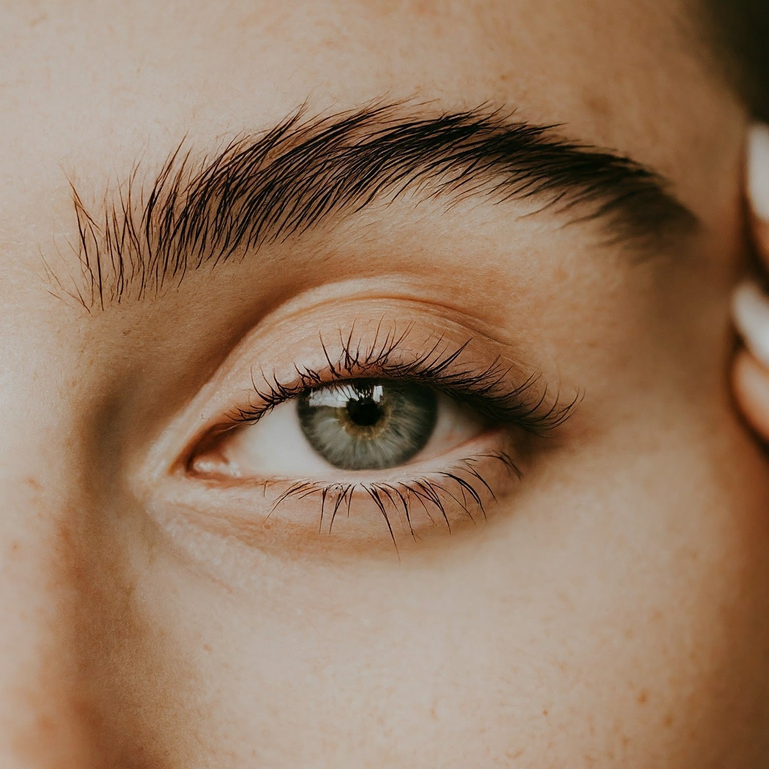 Comment-Prévenir-et-Atténuer-les-Cernes-et-Poches-sous-les-Yeux Al Nilaya